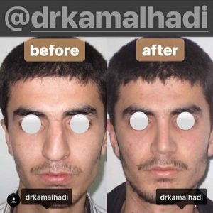 اشتباه پنجم: اقدام به انجام عمل جراحی به دلایل اشتباه است.