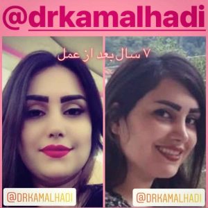 بهترین جراح بینی در تهران