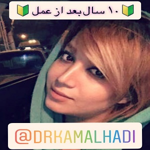 هزینه عمل انواع بینی
