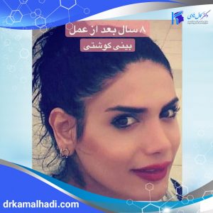 بهترین جراح گوش و حلق و بینی