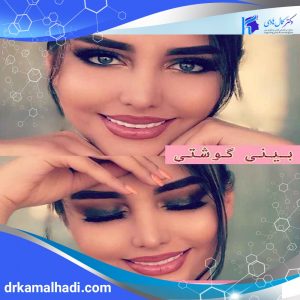 بهترین جراح گوش و حلق و بینی